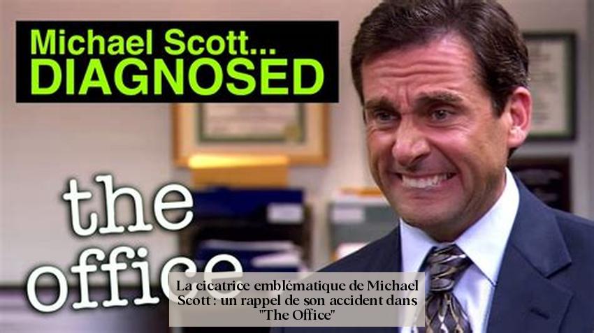 La cicatrice emblématique de Michael Scott : un rappel de son accident dans "The Office"