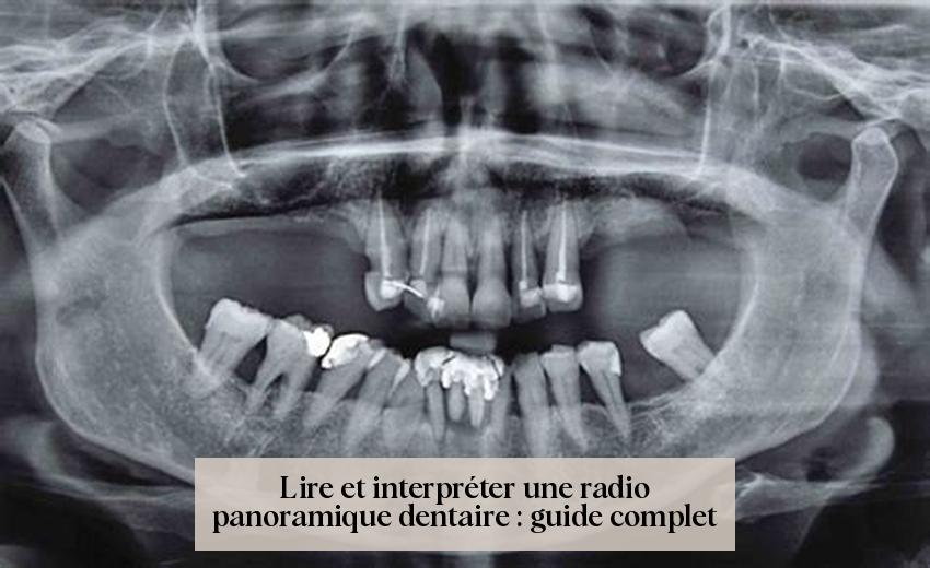 Lire et interpréter une radio panoramique dentaire : guide complet